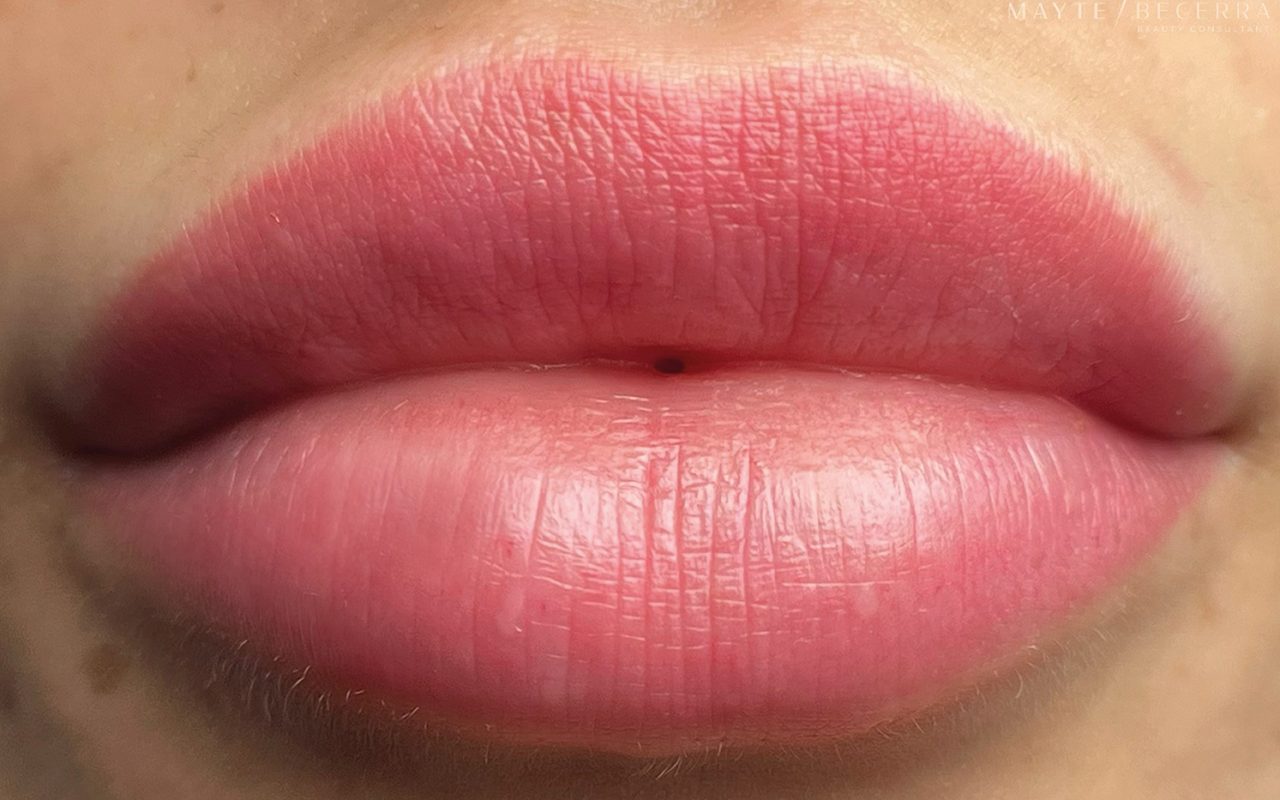 labios