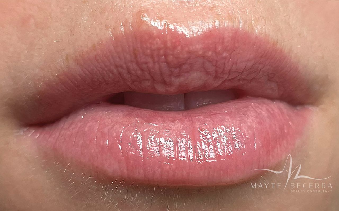 labios